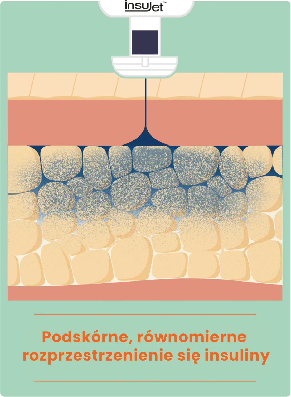 Zalety iniekcji strumieniowej